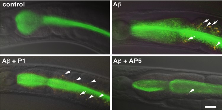 Microscopy images of the anterior intestine of four different C. elegans worms. The gastrointestinal tracts of these worms glow green because they have been fed fluorescent bacteria. Top left: A worm fed normal bacteria. Top right: A worm fed bacteria that contain amyloid beta, which has caused intestinal damage to the worms (white arrows). Bottom left: Intestinal damage is still present if the bacteria contain both amyloid beta and a coil protein that has no effect on aggregation. Bottom right: Intestinal damage is reduced in worms fed bacteria that express amyloid beta and AP5, a synthetic alpha sheet that blocks amyloid beta oligomers. Scale bar is 10 micrometers. Image credit: Shea et al., PNAS, 2019