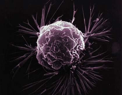 A breast cancer cell up close. Image credit: NCI