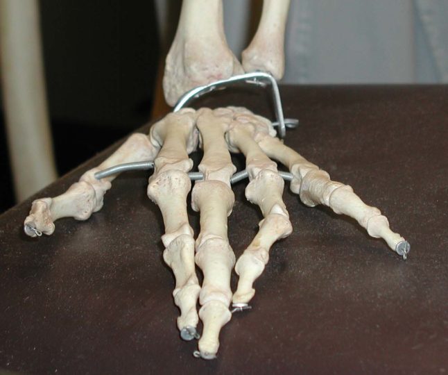 Picture of the bones in a human hand (from an authentic human skeleton).