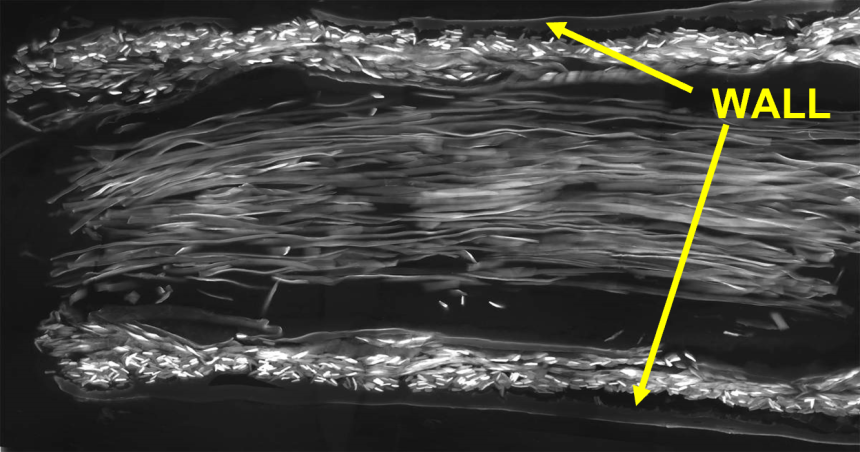 Scanning electron microscope image of a longitudinal section through a silk conduit containing nerve-guiding luminal silk fibres. 