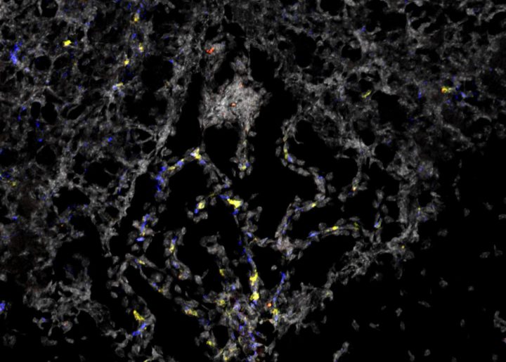 A protein receptor that exists in the smallest blood vessels of our body, called the microvasculature, has been linked to brain disorders such as Alzheimer’s, Parkinson’s, and stroke. Virginia Tech scientists with the Fralin Biomedical Research Institute have discovered that a smaller version of this molecule (highlighted in blue) is present in healthy tissue as well, which could lead to a new understanding of its role in targeted approaches to prevent and treat a variety of health issues.